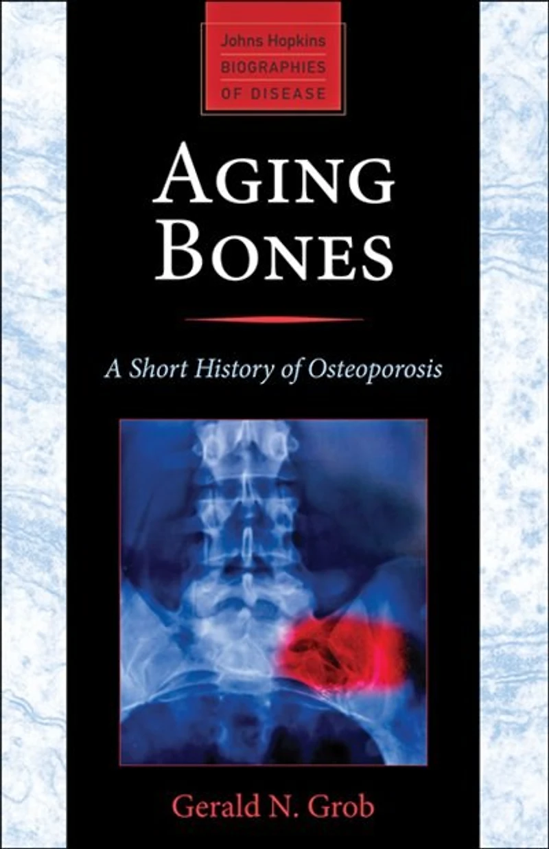 Aging Bones: A Short History Of Osteoporosis
