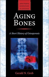 Aging Bones: A Short History Of Osteoporosis