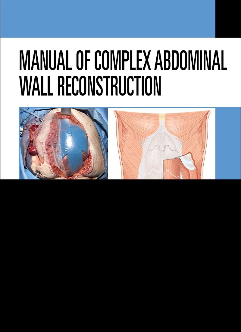 Manual of Complex Abdominal Wall Reconstruction