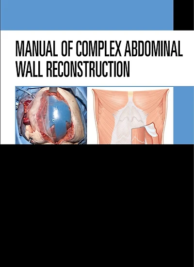 Manual of Complex Abdominal Wall Reconstruction