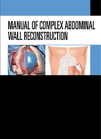 Manual of Complex Abdominal Wall Reconstruction