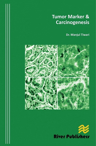 Tumor Marker and Carcinogenesis