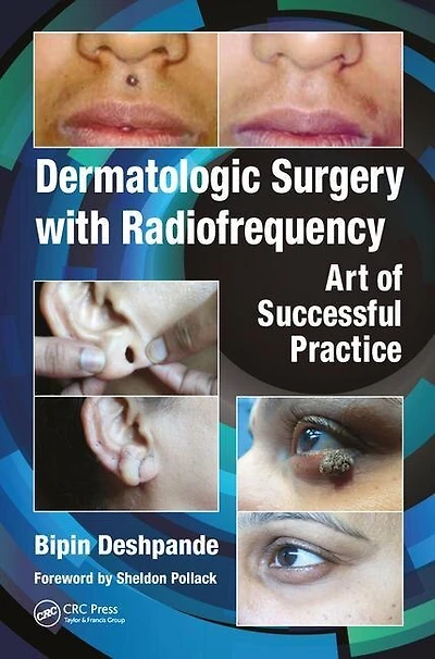 Dermatologic Surgery With Radiofrequency: Art Of Successful Practice