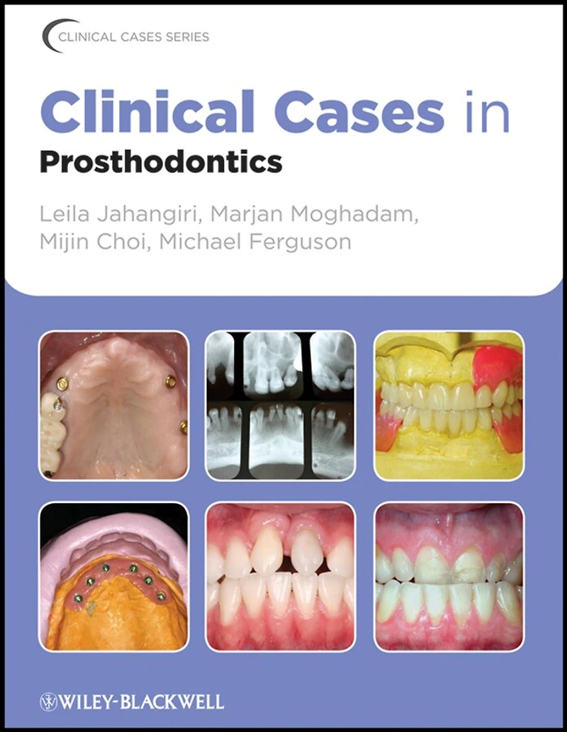 Clinical Cases Prosthodontics