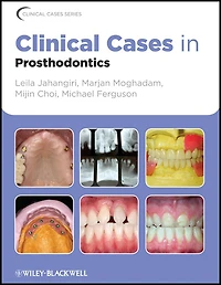 Clinical Cases Prosthodontics
