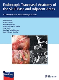 Endoscopic Transnasal Anatomy Of The Skull Base And Adjacent Areas: A Lab Dissection Radiological Atlas