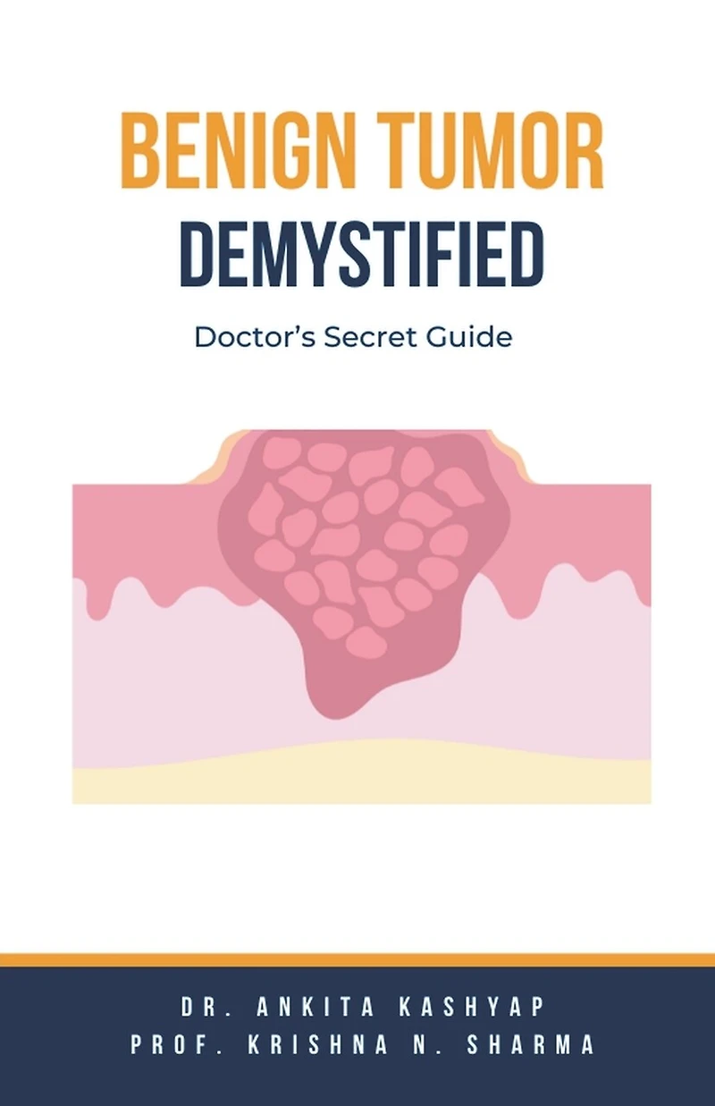 Benign Tumor Demystified: Doctor's Secret Guide