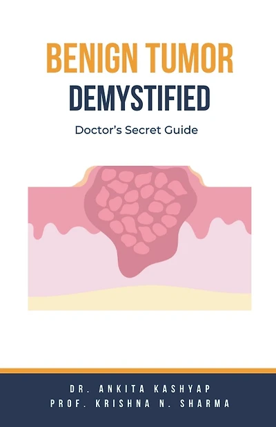 Benign Tumor Demystified: Doctor's Secret Guide