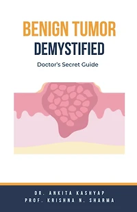 Benign Tumor Demystified: Doctor's Secret Guide