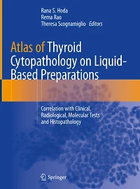 Atlas of Thyroid Cytopathology on Liquid-Based Preparations: Correlation with Clinical, Radiological, Molecular Tests and Histopathology