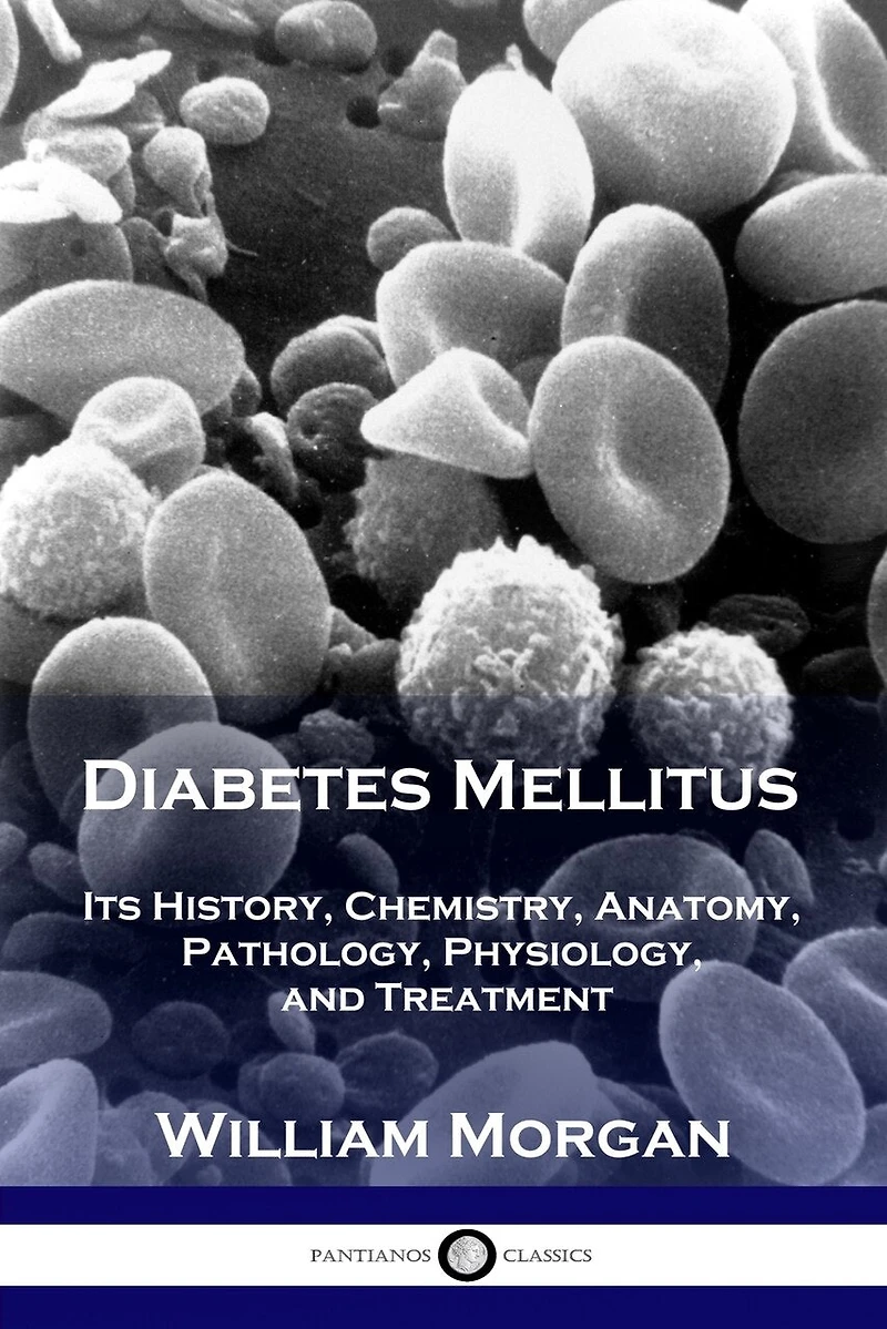 Diabetes Mellitus: Its History, Chemistry, Anatomy, Pathology, Physiology, and Treatment