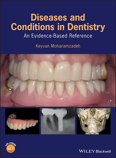 Diseases and Conditions Dentistry: An Evidence-Based Reference
