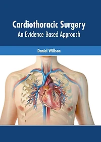 Cardiothoracic Surgery: An Evidence-based Approach