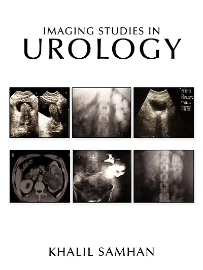 Imaging Studies In Urology