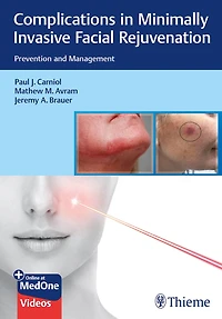 Complications Minimally Invasive Facial Rejuvenation: Prevention And Management