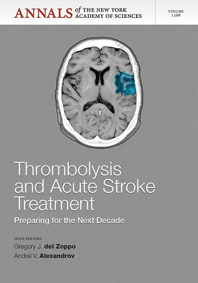 Thrombolysis and Acute Stoke: Preparing for the Next Decade, Volume 1268