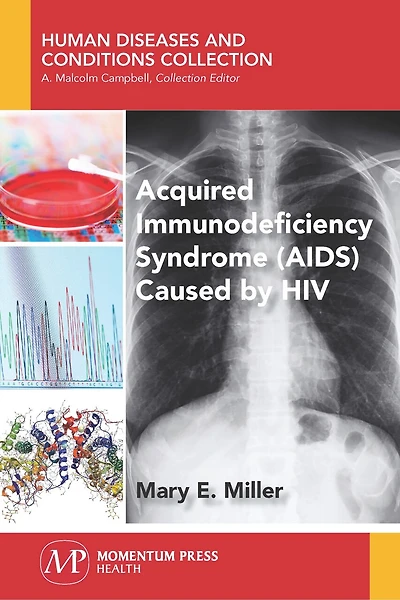 Acquired Immunodeficiency Syndrome (aids) Caused By Hiv