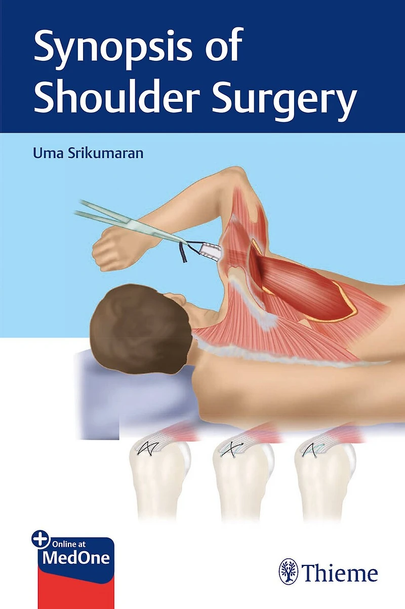 Synopsis Of Shoulder Surgery