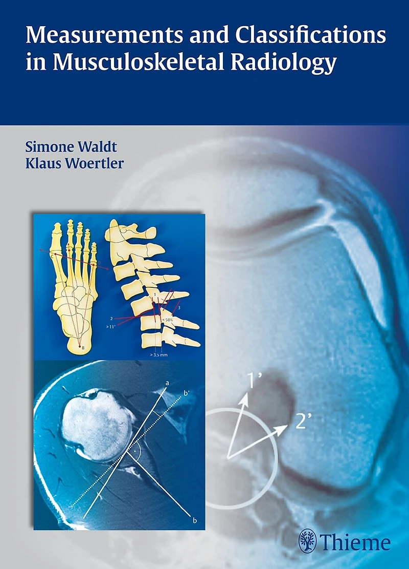 Measurements And Classifications Musculoskeletal Radiology