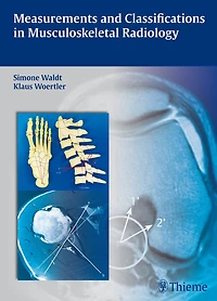 Measurements And Classifications Musculoskeletal Radiology