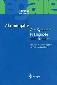 Akromegalie -- Vom Symptom Zu Diagnose Und Therapie: Eine Klinische Monographie Mit Patientenberichten