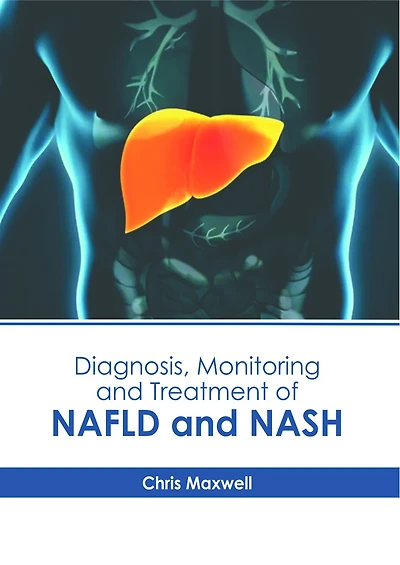 Diagnosis, Monitoring and Treatment of NAFLD and NASH