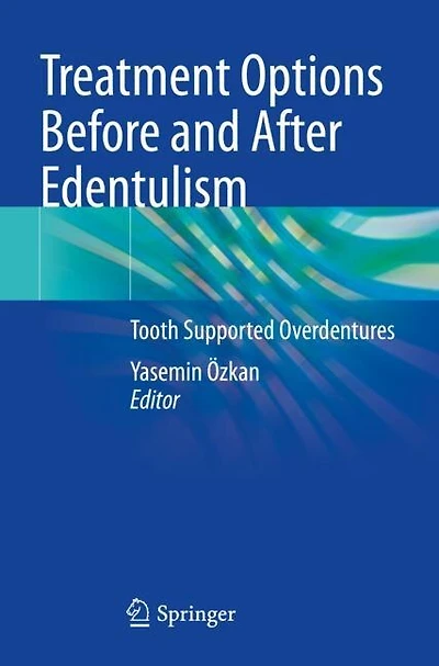 Treatment Options Before and After Edentulism: Tooth Supported Overdentures