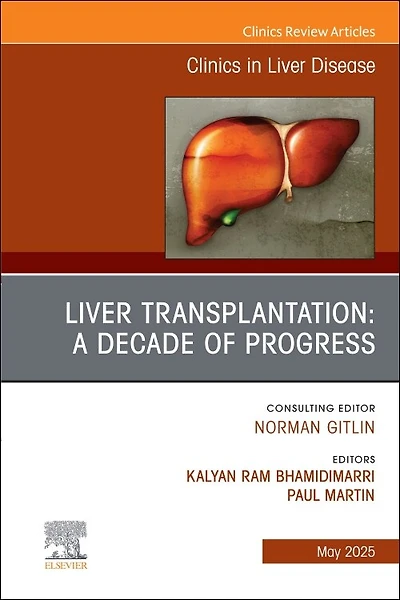 Liver Transplantation: A Decade of Progress, An Issue Clinics Disease