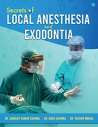 Secrets of Local Anesthesia and Exodontia