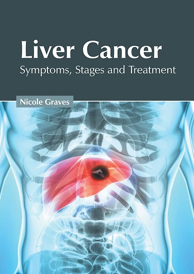Liver Cancer: Symptoms, Stages And Treatment