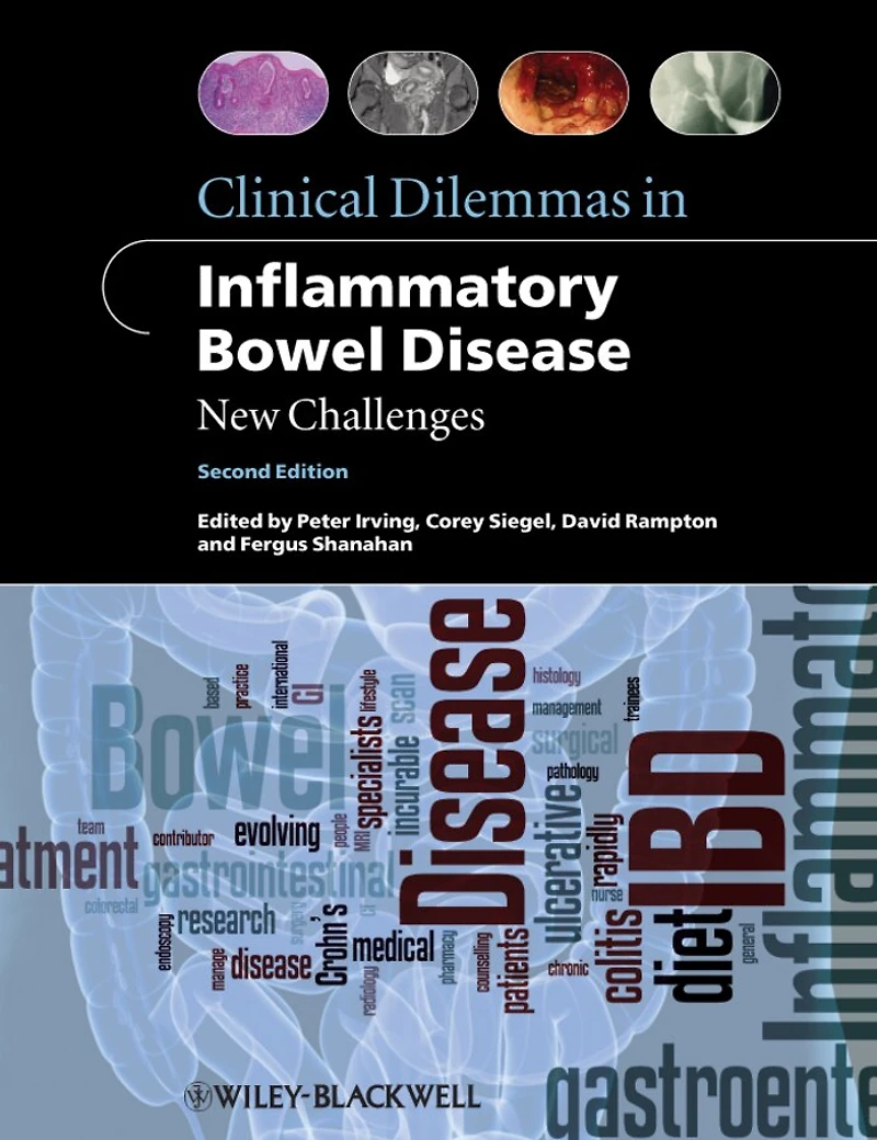 Clinical Dilemmas Inflammatory Bowel Disease: New Challenges