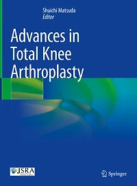 Advances Total Knee Arthroplasty