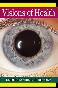 Visions of Health: Understanding Iridology