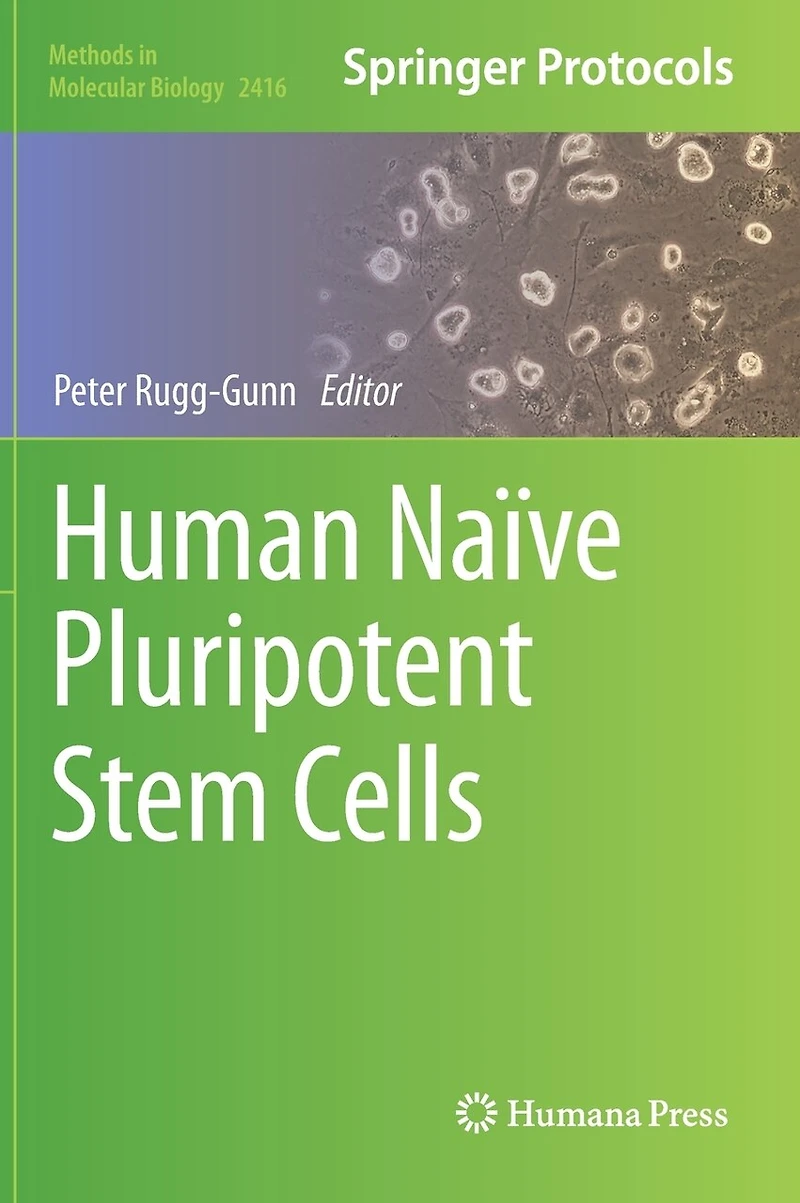Human Naive Pluripotent Stem Cells