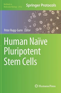 Human Naive Pluripotent Stem Cells