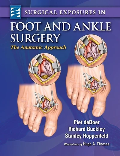 Surgical Exposures Foot and Ankle Surgery: The Anatomic Approach