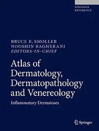 Atlas Of Dermatology, Dermatopathology And Venereology: Inflammatory Dermatoses