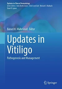 Updates Vitiligo: Pathogenesis and Management