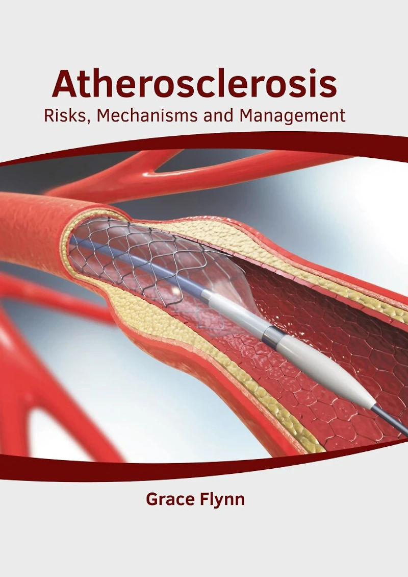 Atherosclerosis: Risks, Mechanisms And Management