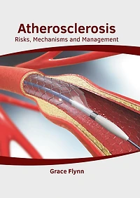 Atherosclerosis: Risks, Mechanisms And Management