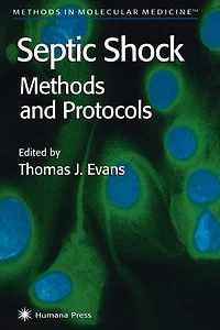 Septic Shock Methods and Protocols
