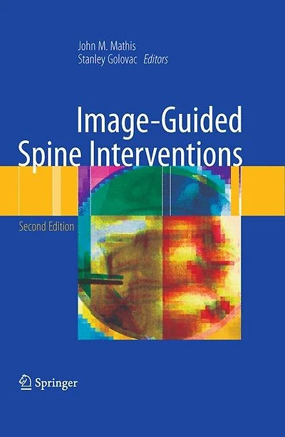 Image-guided Spine Interventions