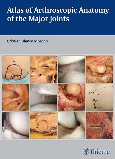 Atlas Of Arthroscopic Anatomy The Major Joints