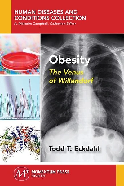 Obesity: The Venus Of Willendorf