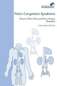 Pelvic Congestion Syndrome - Chronic Pelvic Pain And Pelvic Venous Disorders