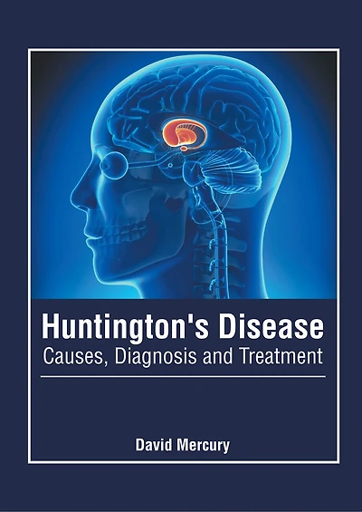 Huntington's Disease: Causes, Diagnosis And Treatment