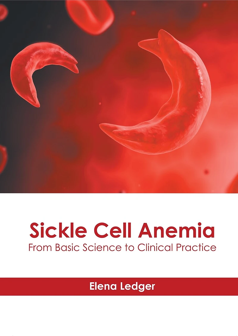 Sickle Cell Anemia: From Basic Science To Clinical Practice