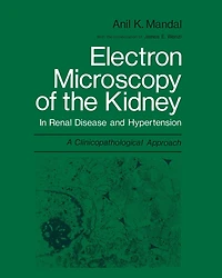 Electron Microscopy of the Kidney: In Renal Disease and Hypertension: A Clinicopathological Approach