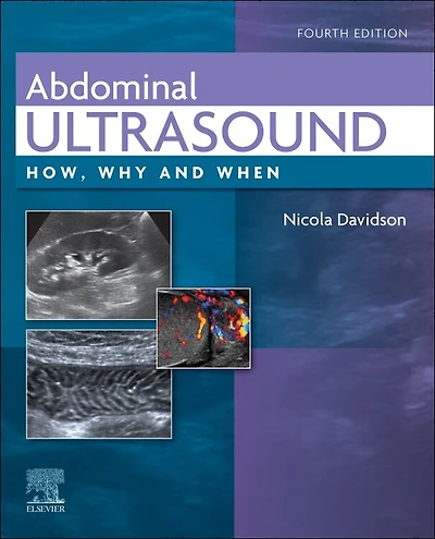 Abdominal Ultrasound: How, Why And When