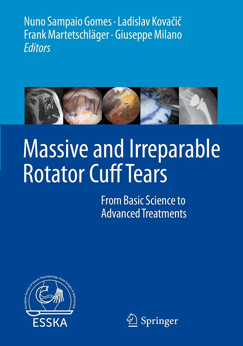 Massive and Irreparable Rotator Cuff Tears: From Basic Science to Advanced Treatments